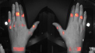 both_inflammationImage