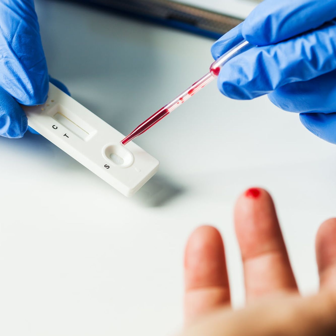 in-vitro diagnostics